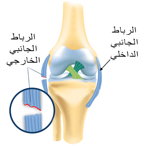الرباط الجانبي