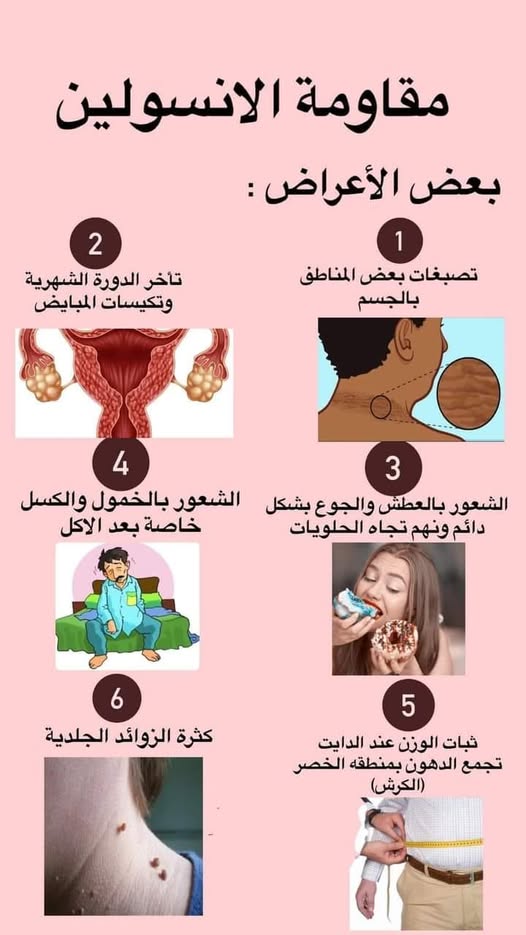 أعراض مقاومة الأنسولين بالصور